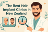The Best Hair Implant Clinics in New Zealand bikrisohoj